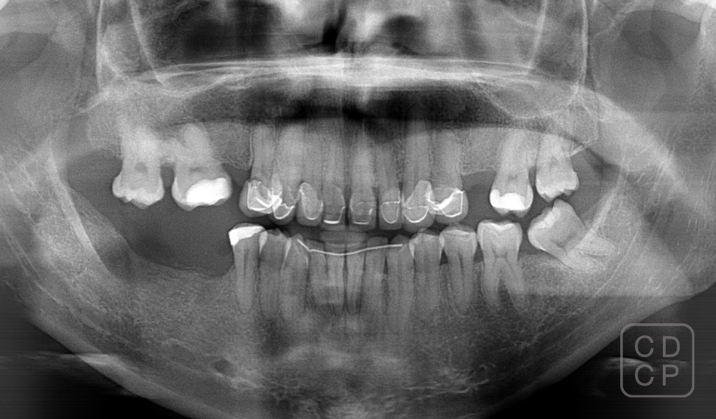 cas real de rehabilitació dental